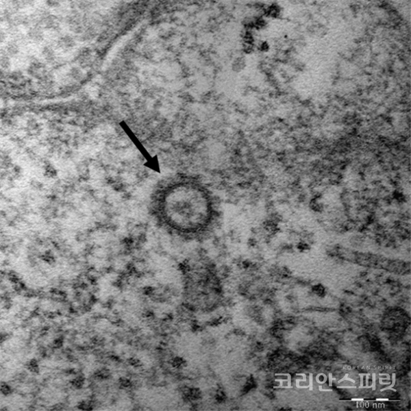 코로나19 바이러스(SARS-CoV-2)의 전자현미경 사진. [사진=질병관리본부]