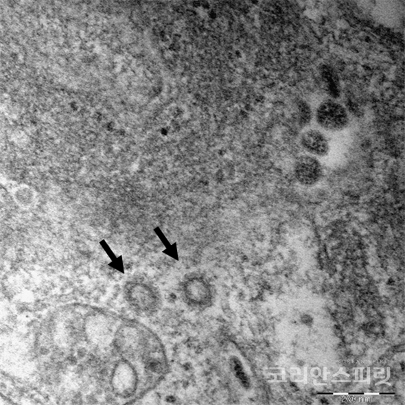 코로나19 바이러스(SARS-CoV-2)의 전자현미경 사진.   코로나바이러스 입자 크기: 80-100nm.  나노미터(nm)는 1/천만 센티미터(cm), [사진=질병관리본부]