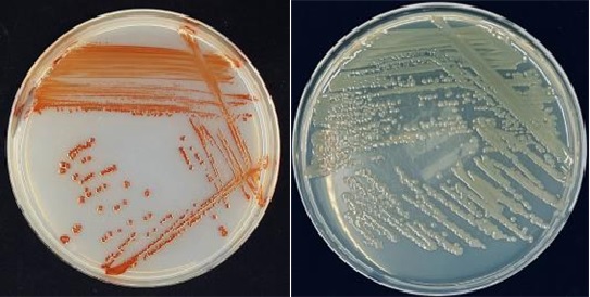 항생물질 생성 세균 사진. 이미지 국립호남권생물자원관.