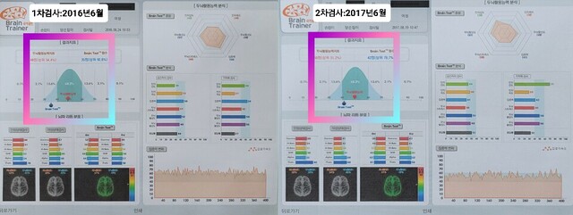 채원이의 뇌파검사 결과지. 2016년 8월과  2017년 8월 결과. 사진 본인 제공.