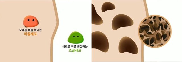 우리 뼈는 35세 전후 골량이 줄어들기 시작하며, 여성은 폐경 전후 매우 빠른 속도로 골량이 줄어든다. 사진 일지의 브레인TV 갈무리.